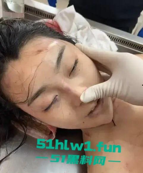 大连女孩【徐园】惨死男友家中，男友却被判无罪，案件再度发酵，尸检细节曝光震惊全网！-6