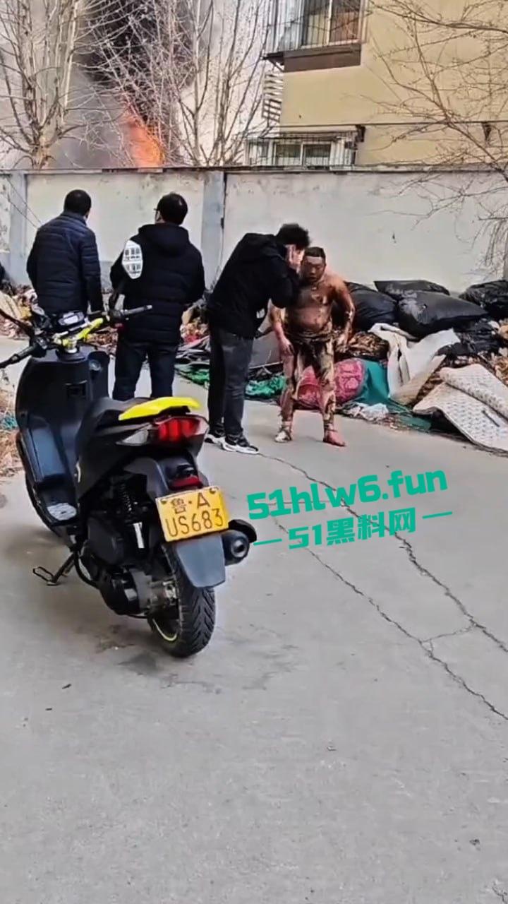 山东济南一小区发生火灾,男子被烧的体无完肤,经调查是邻居大妈积攒的废品导致烧成这样也太惨了。-1