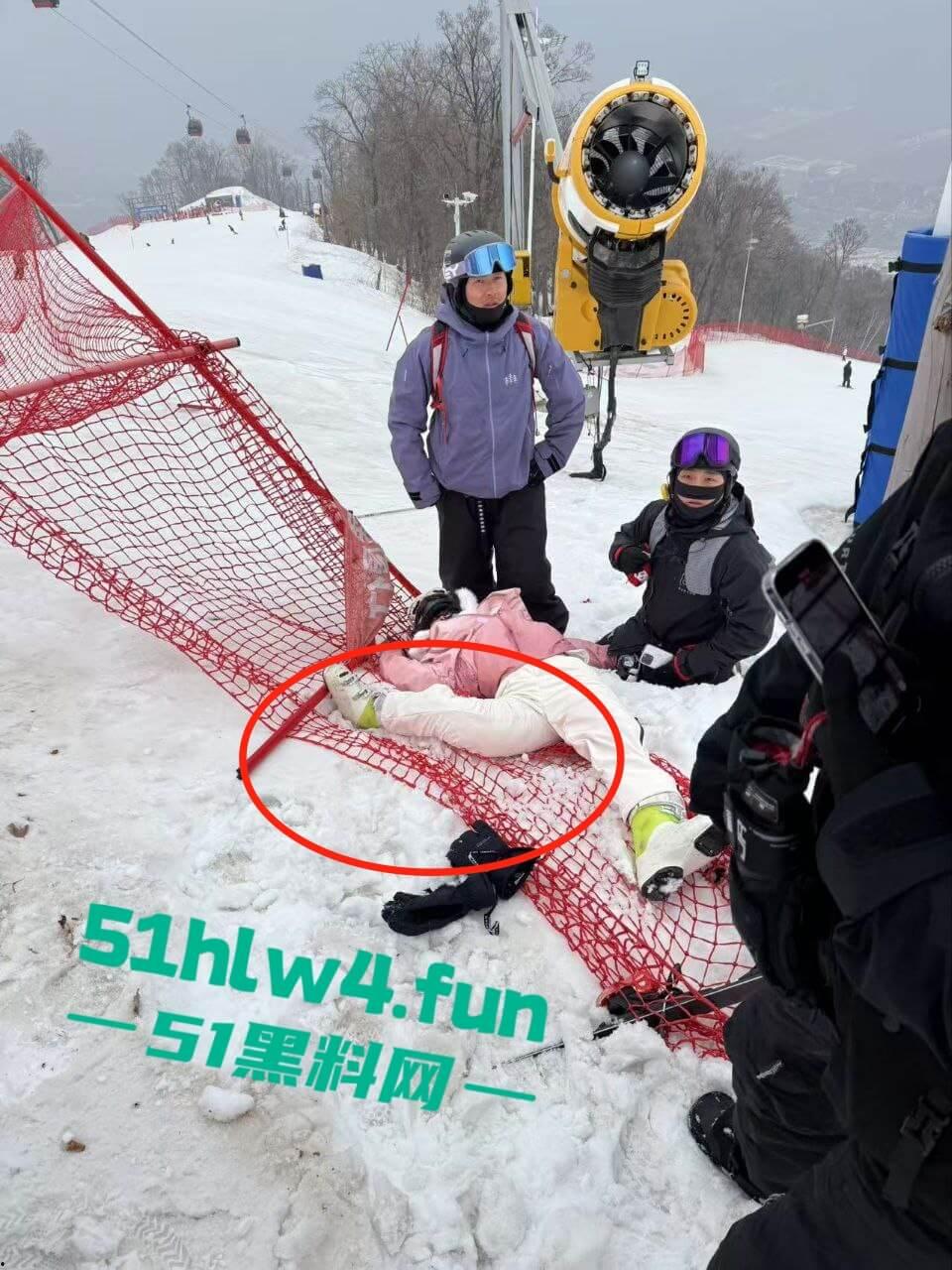 北大湖滑雪场新手滑雪妹,误入中高级滑道滑雪,不慎摔飞被撞到变形断腿场面超吓人。-1