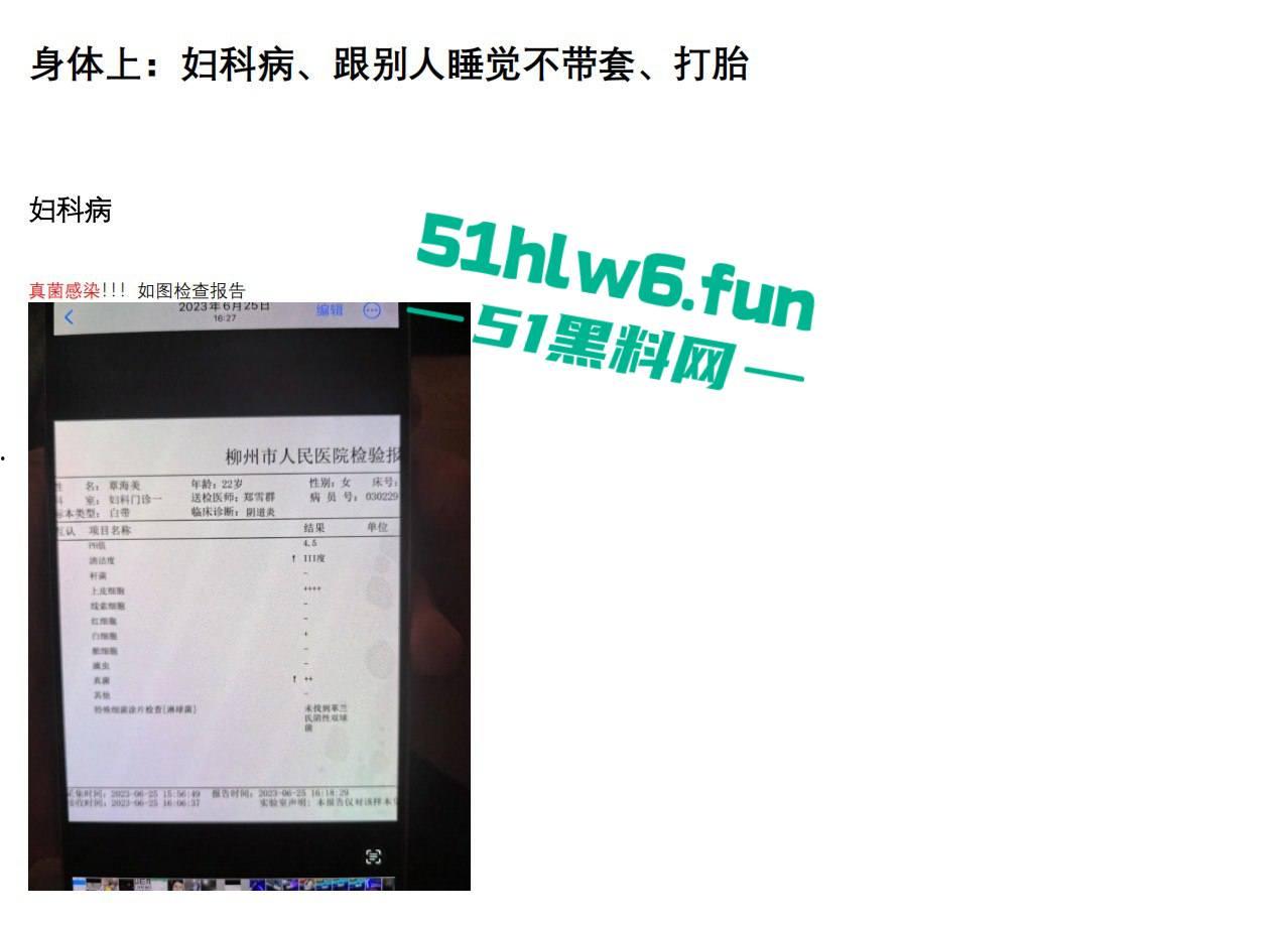 实名曝光婊子!柳州坐台妹梁献宜私生活糜烂不堪还玩弄别人感情,多次出轨打炮引发骚逼炎症。-19