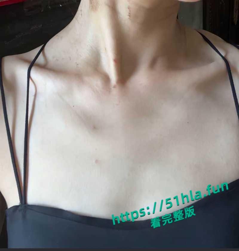 抖音女网红【轮滑冰姑娘】生化母体携带艾滋感染上千人人设翻车,遭网友质疑健康状况引发争议!-15