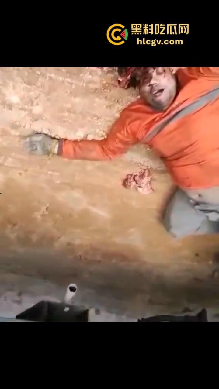 太惨了!因操作不当 巴西倒霉男子脑袋被挤爆 血腥现场视频曝光 胆小慎入-8