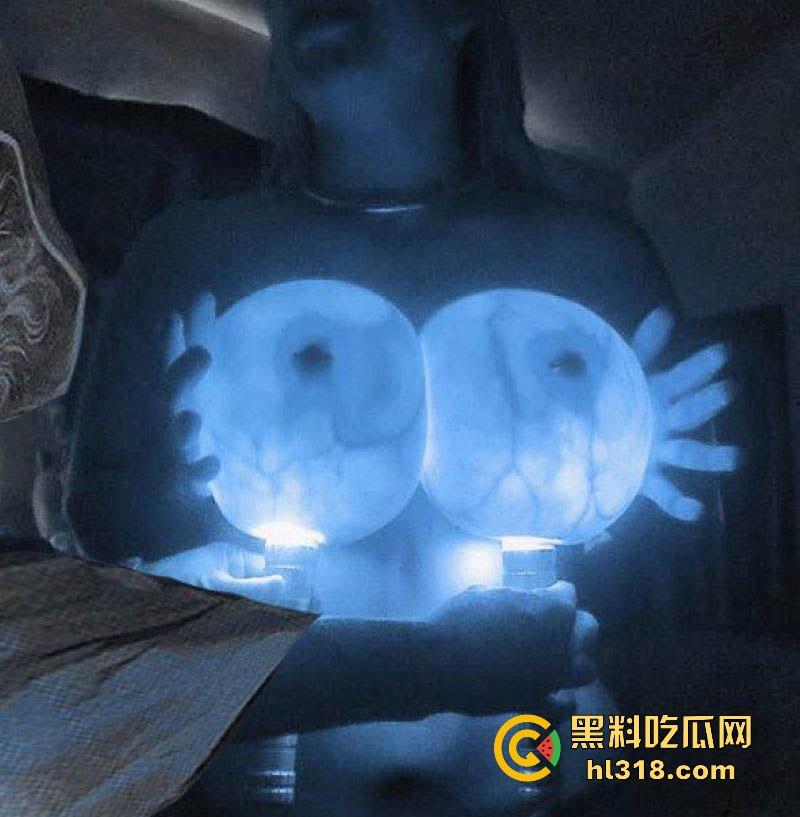 教大家如何分辨假胸,其实假胸跟灯罩一个道理,打灯上去就会完全透,宛如一个宇宙飞船!-1