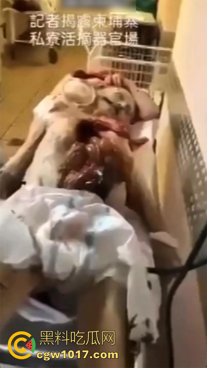 柬埔寨器官交易场实拍,猪仔狗推的最终贩卖地,难怪这里每个人都值钱,只要血型匹配有买主,立刻就会被拉走!-2