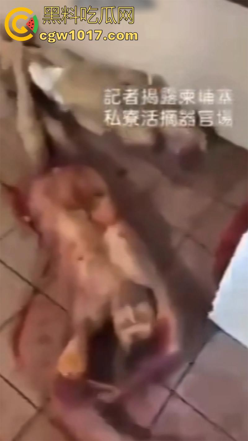 柬埔寨器官交易场实拍,猪仔狗推的最终贩卖地,难怪这里每个人都值钱,只要血型匹配有买主,立刻就会被拉走!-8