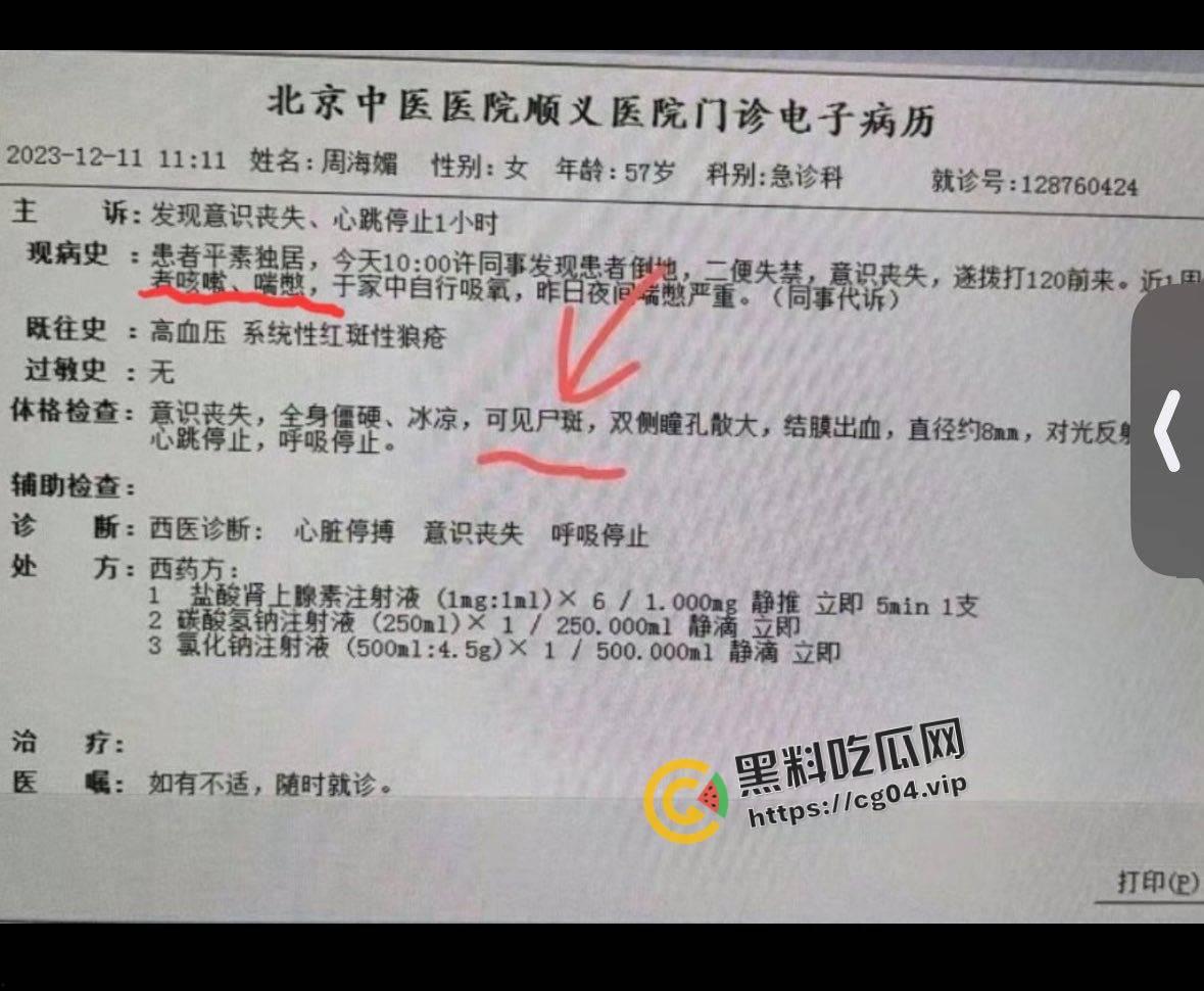 最新！周海媚死亡病例流出 去世前身上已有尸斑  流出的医生将被严惩-1