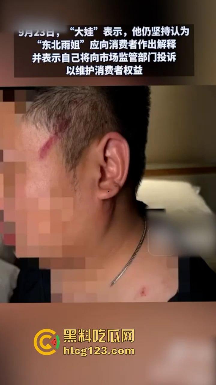 一分钟收入100w？抖音千万网红 【东北雨姐】售卖假红薯粉粉涉嫌虚假宣被打假！-16