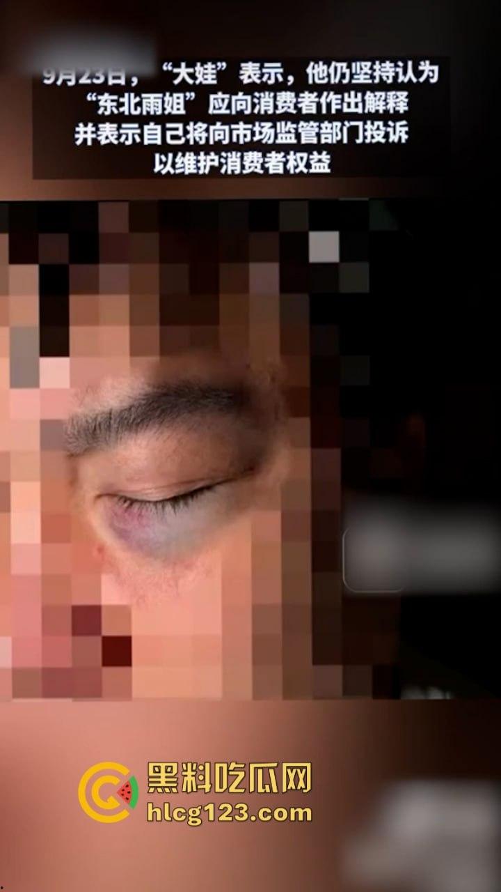 一分钟收入100w？抖音千万网红 【东北雨姐】售卖假红薯粉粉涉嫌虚假宣被打假！-18