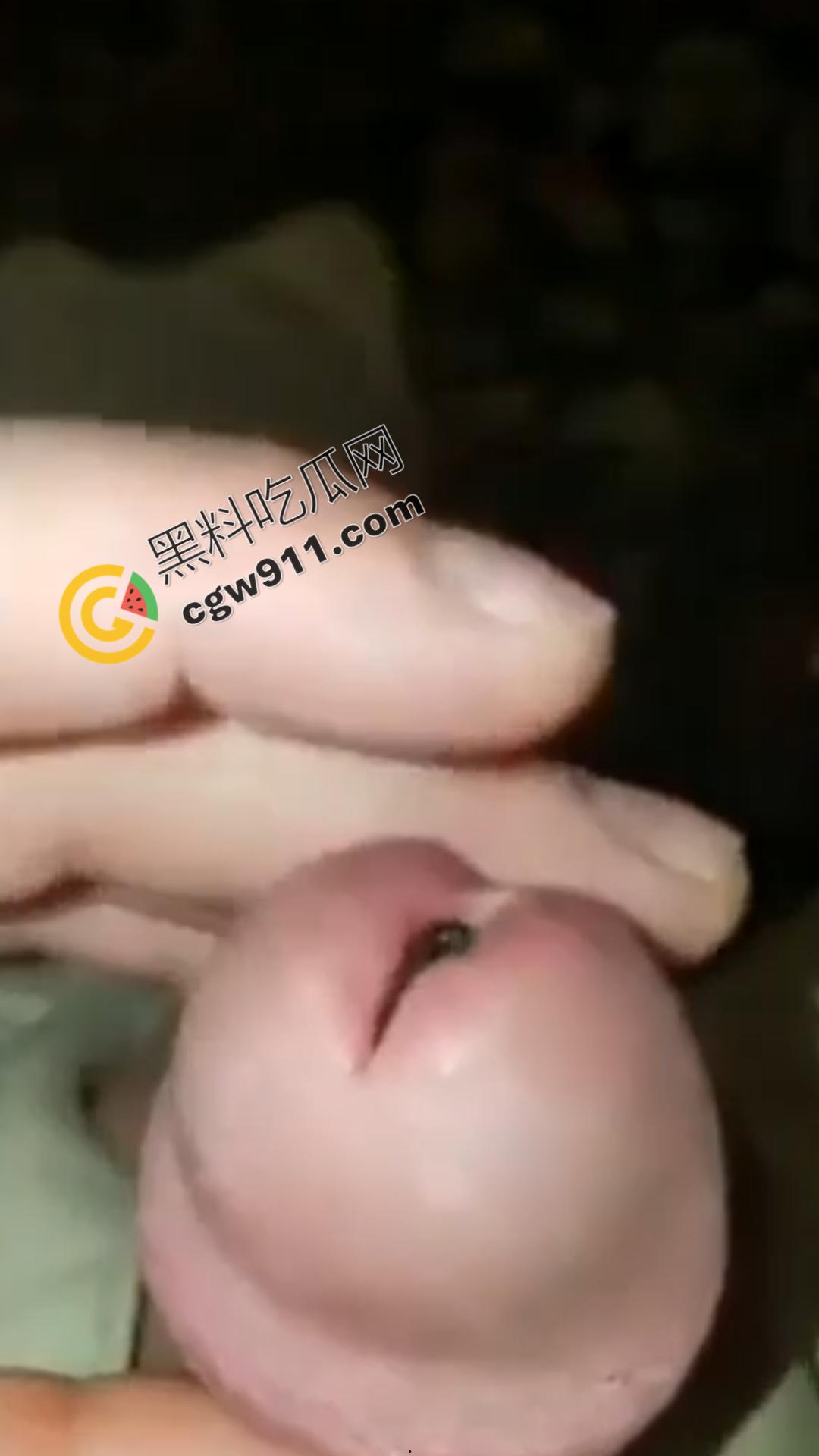 恐怖刺激！活蚂蟥钻入男子大屌的惊悚作死视频，观看者直呼恶心，视觉冲击骇人听闻-5