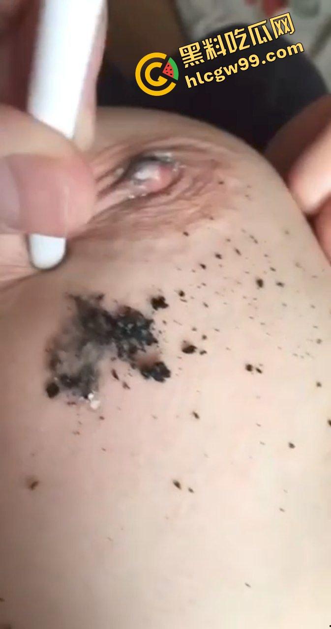 江苏极品E奶大雷少妇骚鸡,尝试猎奇刺激玩法虐乳!暴力夹乳针头注射奶头烟头烫咪咪!诠释何为调教!-9