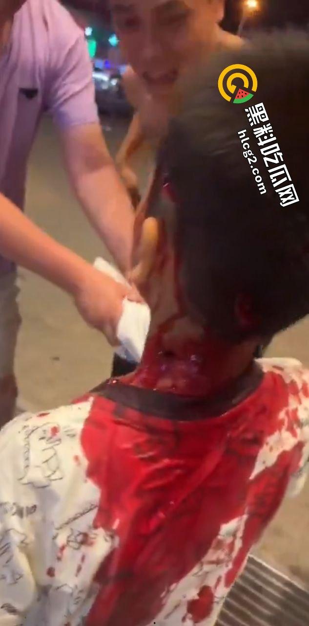 广西玉林南兴广场 精神病男子袭击广场砍人 下死手砍颈动脉 血迹斑斑！致4名小孩受伤！-9