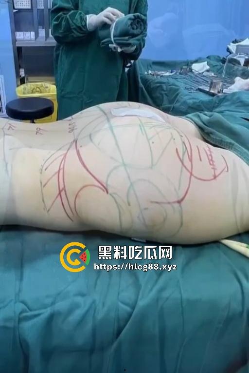 现在妹子为美疯魔抽脂隆奶塞逼艾灸，骚穴子宫烤得喷香，医美变态到艾灸鸡巴都出现了！-10