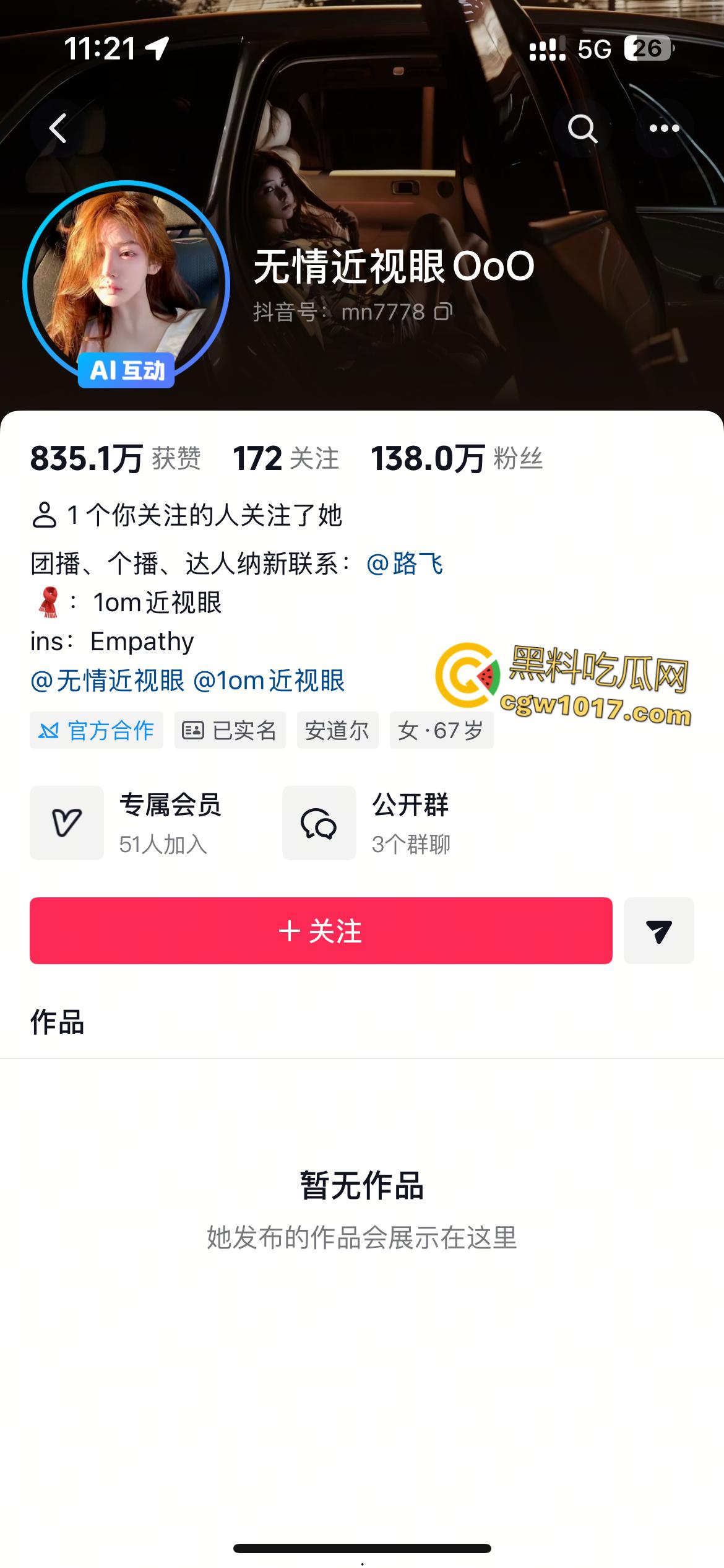 极品御姐网红【无情近视眼】，写真私拍流出，良家少妇变顶级骚货，豪乳蜜桃臀撩人，眼神饥渴血脉喷张！-1
