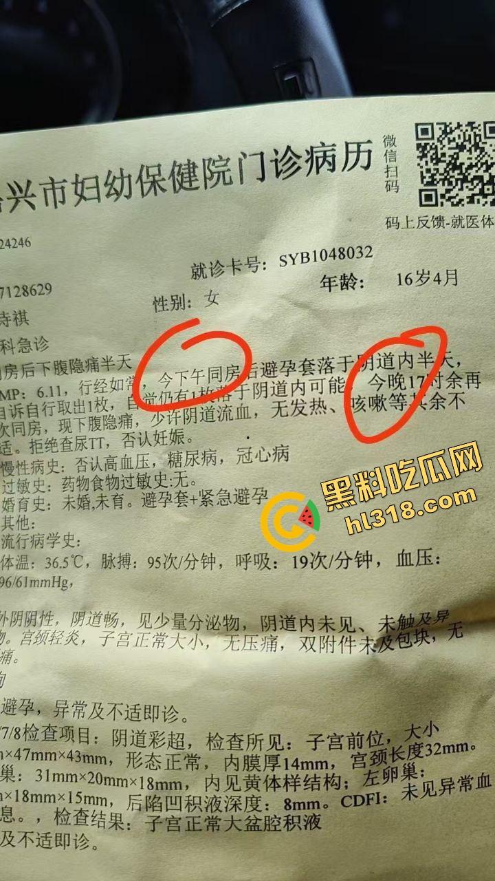 浙江嘉兴女骑『王诗琪』偷人搞到套套卡阴道还拉男友陪诊，男友最后发现自己是大冤种小丑！-3