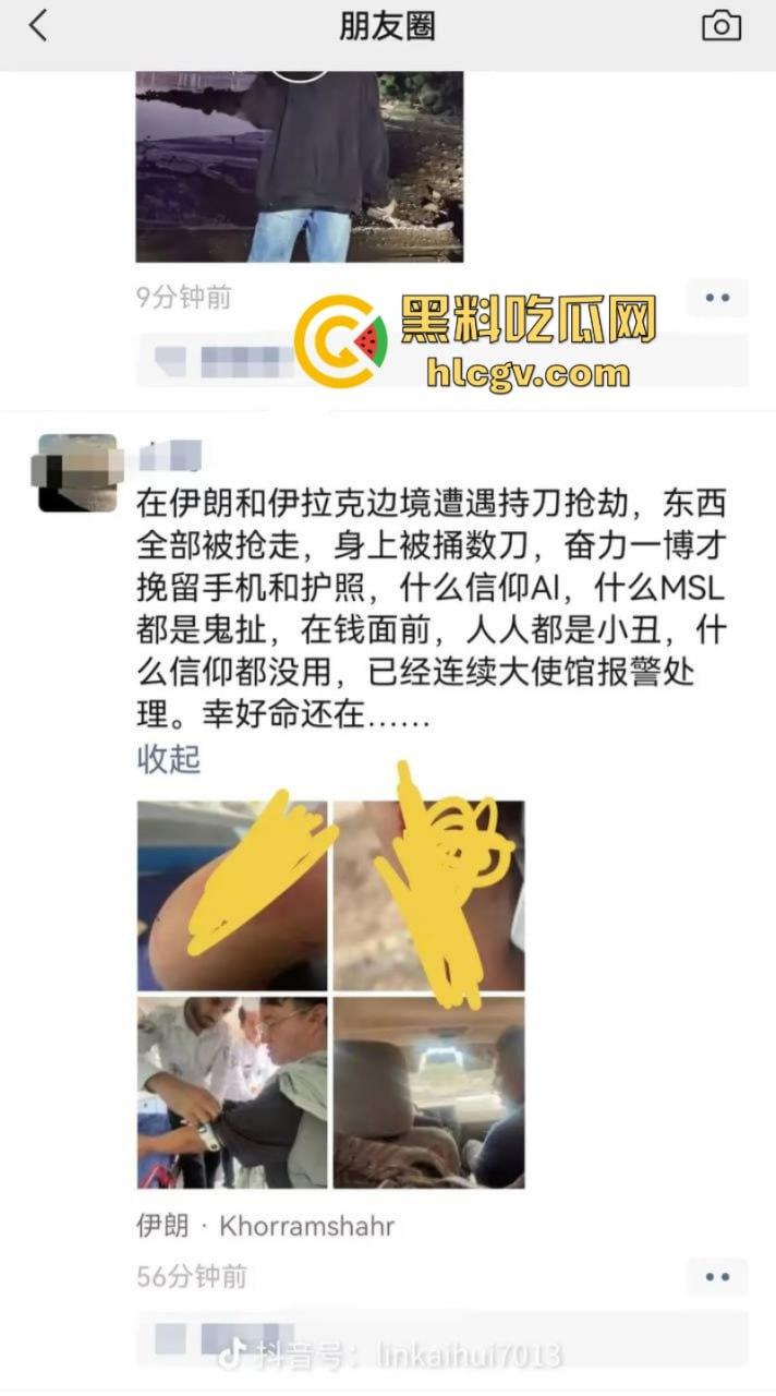 旅游博主在伊朗遭遇持刀抢劫 身中数刀死里逃生 为流量也是不要命了-7