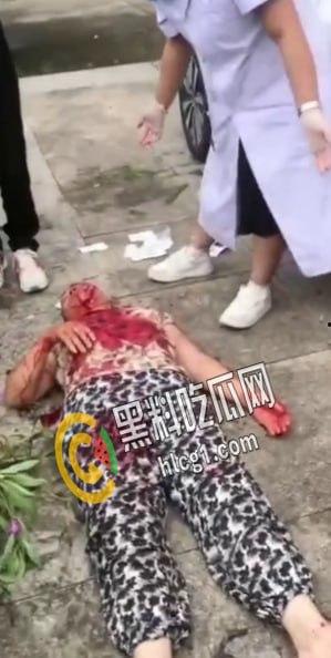 畜生行为！浙江海宁市周王庙镇 畜生孙子为了一个西瓜爆打奶奶 把奶奶打到浑身是血 倒地不起-5