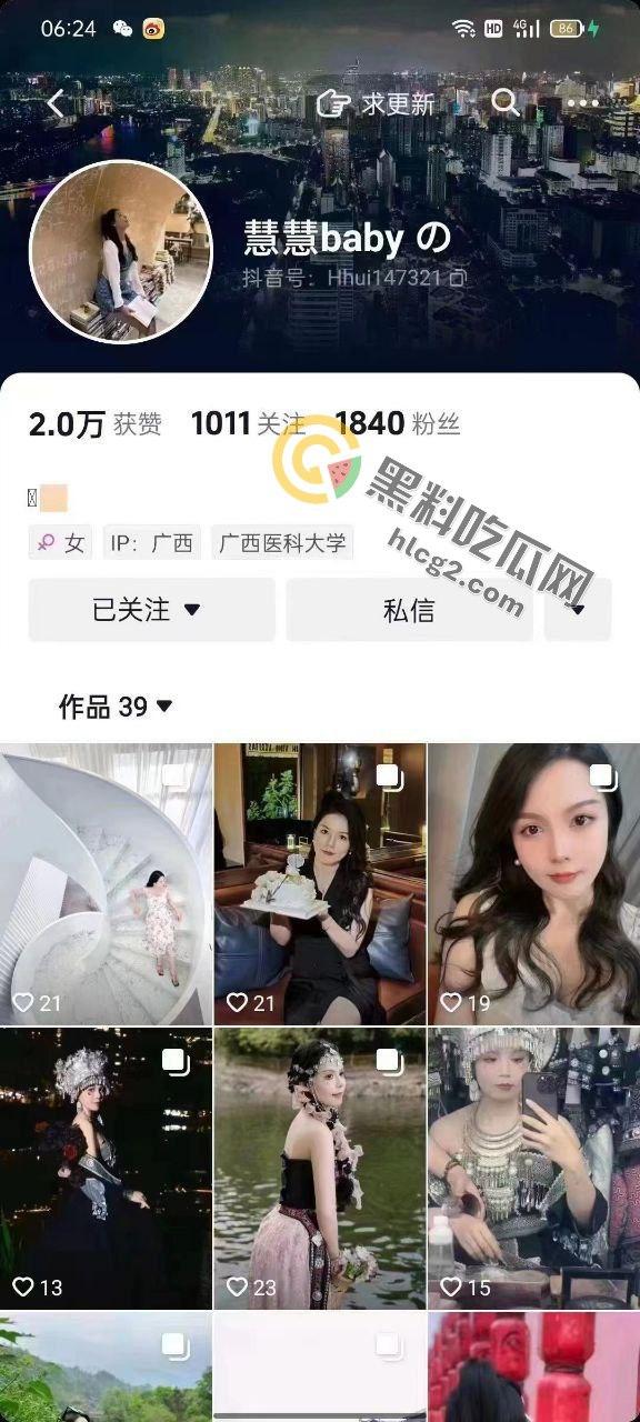 网红慧慧baby出轨丑闻曝光！甜美网红背后的秘密竟如此劲爆！-1