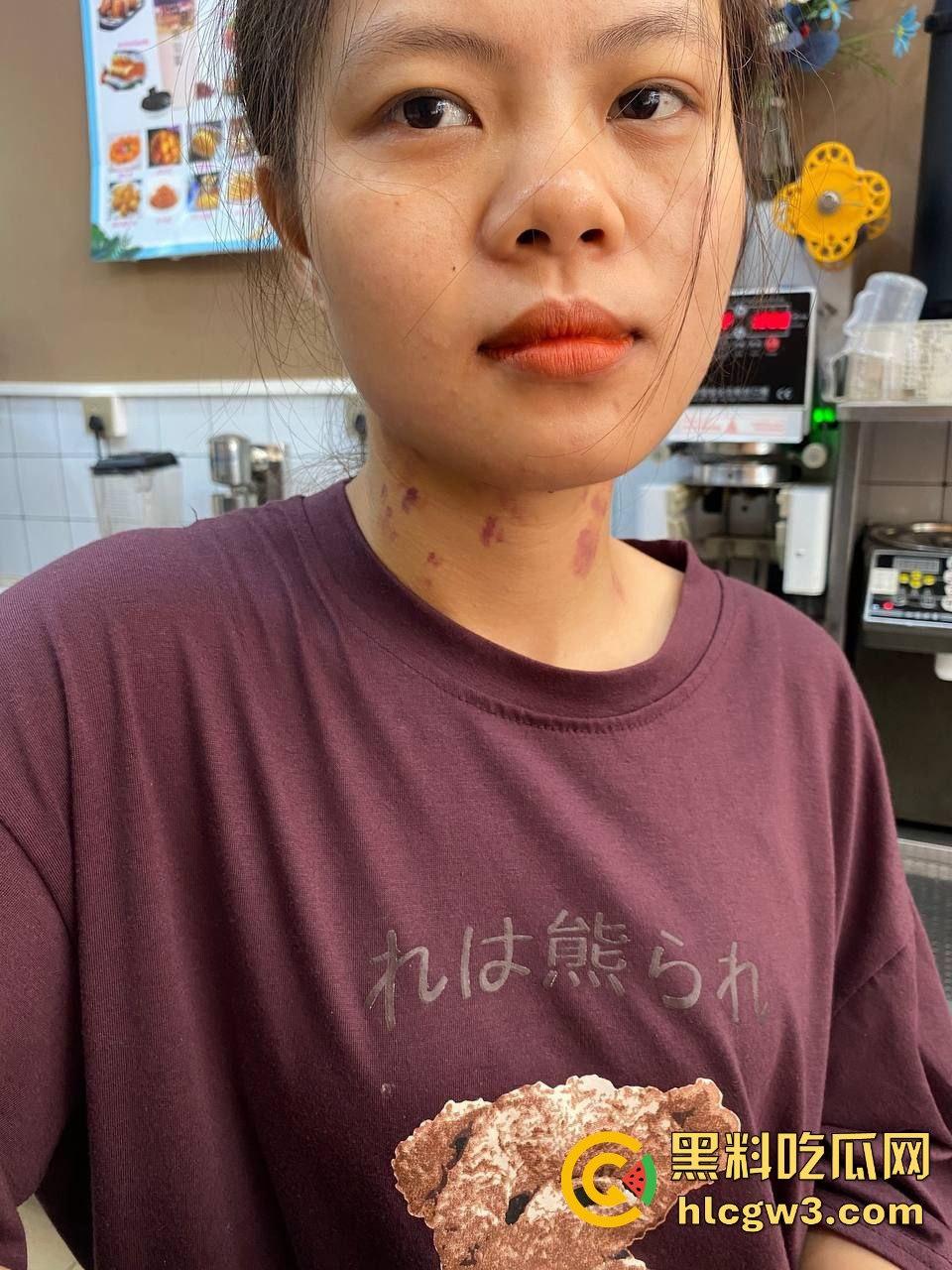 河南骚货【赵露露】的母狗身份被男友实锤 ，裸照生活照全曝光，脖子草莓遍布像得了病一样-10