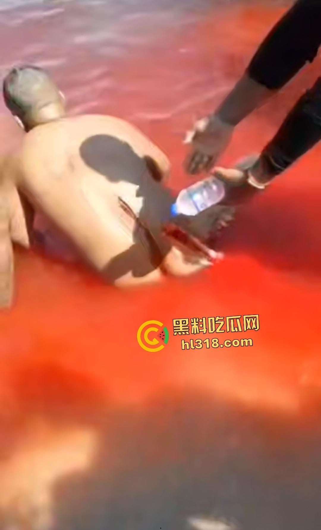 黑人男子海边遭螺旋桨血腥绞杀!下半身肉烂血染红海,旁人妄图复原断肢,谁知身体差点变两半!-3