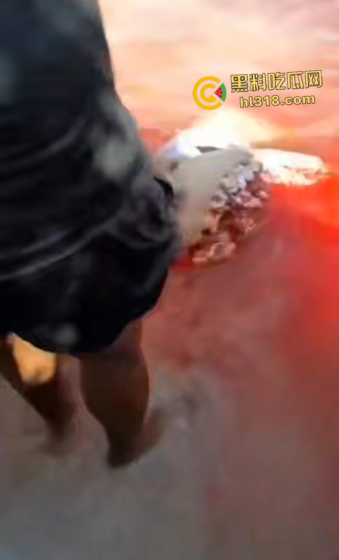 黑人男子海边遭螺旋桨血腥绞杀!下半身肉烂血染红海,旁人妄图复原断肢,谁知身体差点变两半!-5