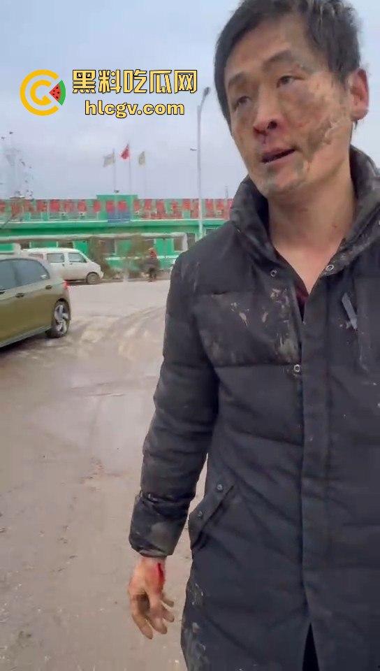 山东临沂孔孟之乡变菜鸡互啄场，两男因超车打成泥脸怪！-5