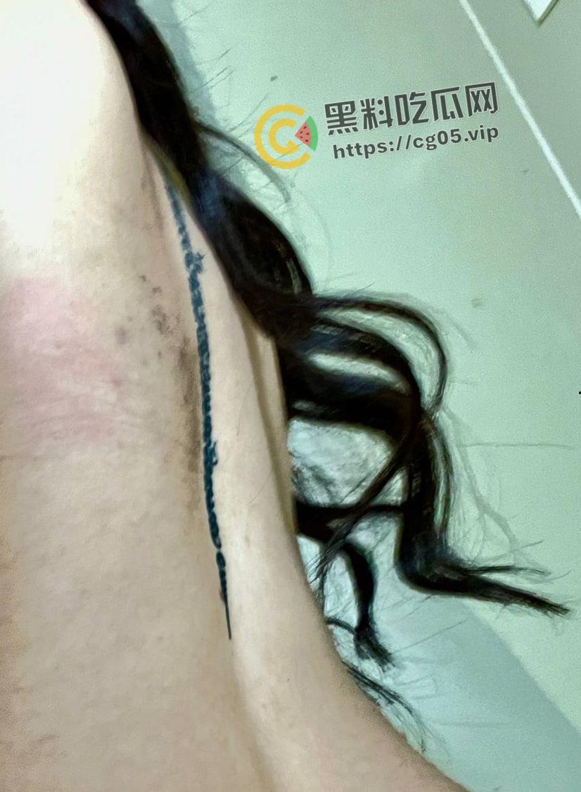 上海鸭王【闫啸天】和鸡婆的狗血爱情故事！鸭王性病 偷吃打鸡婆打到流产 属于是烂人比烂 家暴现场血腥画面流出-6