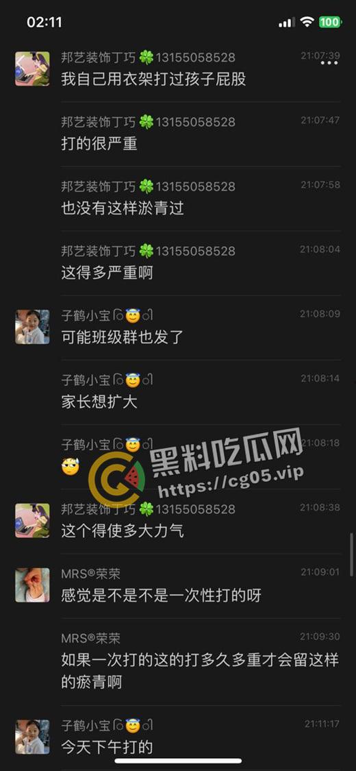 泰州外国语小学老师暴打小学生 全身淤青 家长群内声讨被解散 至今无说法-6