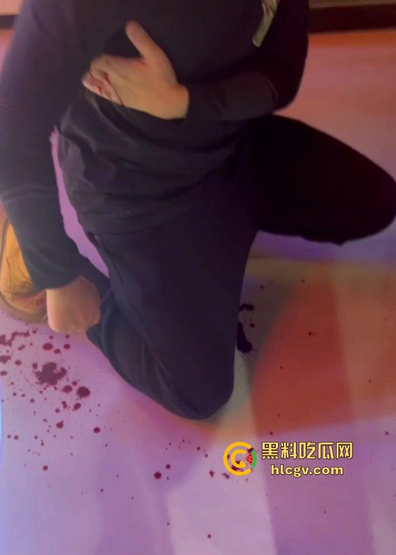 江苏南通小米su7小伙大战摩托人后续 小伙单杀一人 嘲讽哥侥幸存活 朋友惨被祭天！-6