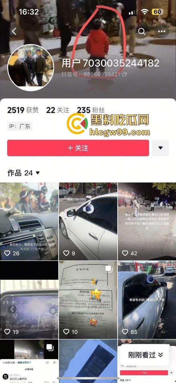 潮汕男子飙车狂言车300万撞死人保险赔，结果被英歌队打到脑震荡，现在出院嚷嚷黑势力又被围了！-1
