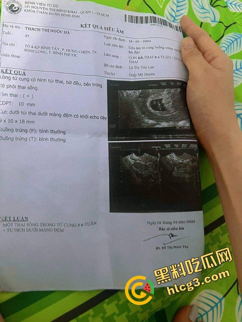 我和缅甸女友的爱情故事！这就是缅甸女的真实面孔-1