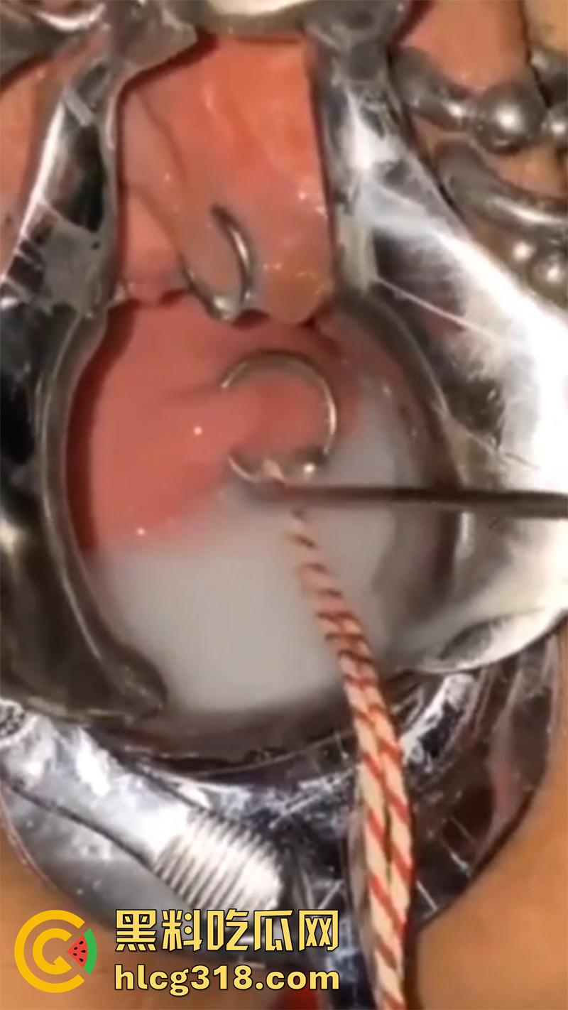 重口极限引导扩张虐穴，逼里塞图钉钢管插子宫口，鸡巴爆插尿道操的骚逼白浆四溢，宫颈真像个鱼唇！-8