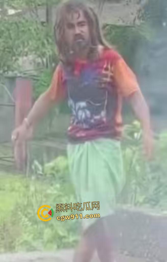 英国穷鬼流浪汉狠炸自己！老婆跑路绝望拿鞭炮塞嘴自爆折磨，威力太小没死成却逗乐路人狂笑！-4