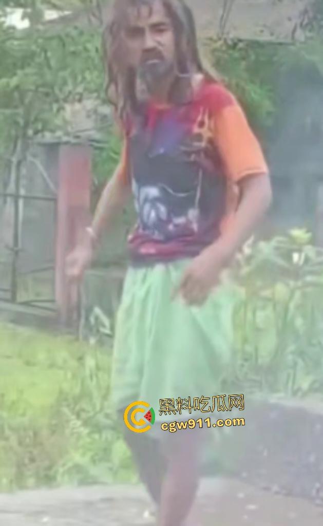 英国穷鬼流浪汉狠炸自己！老婆跑路绝望拿鞭炮塞嘴自爆折磨，威力太小没死成却逗乐路人狂笑！-6