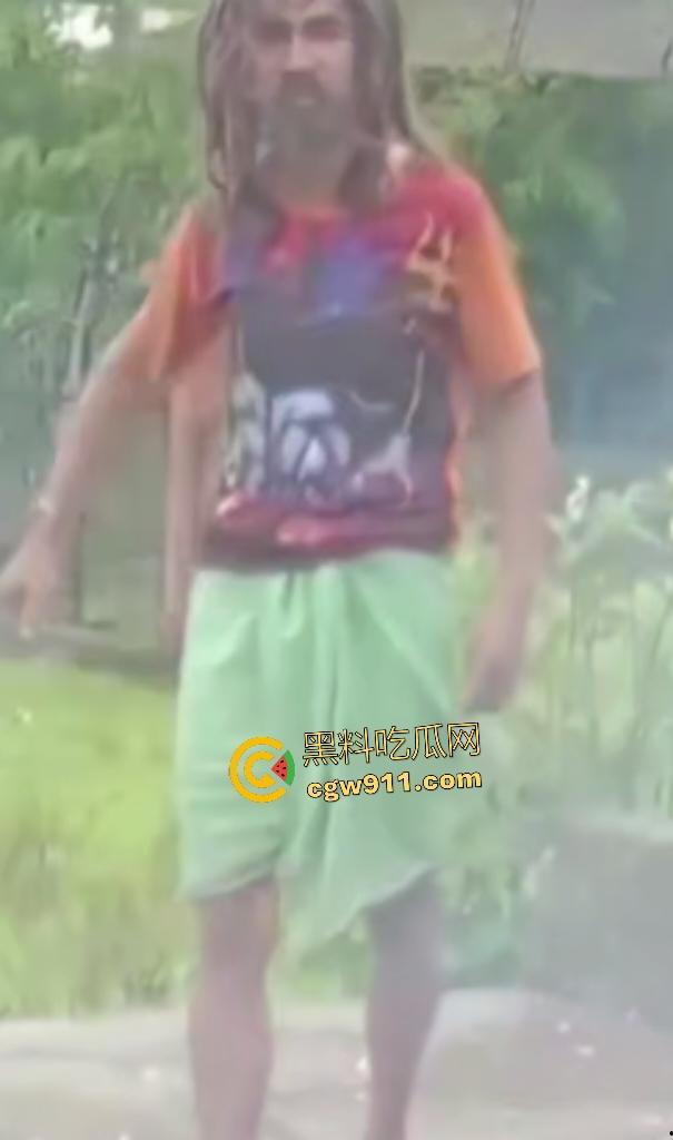 英国穷鬼流浪汉狠炸自己！老婆跑路绝望拿鞭炮塞嘴自爆折磨，威力太小没死成却逗乐路人狂笑！-7