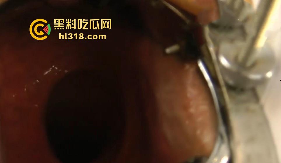 重口慎入！欧美骚妇变态扩肛，超大号道具捅菊花直至小腹隆起，直肠深处清晰呈现，这可真是一步到胃啊！-8