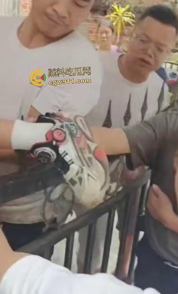 广西梧州小孩贪玩翻栏杆铁尖直穿小腿,血肉模糊挂半空,围观群众消防齐心救命,小孩一声不吭痛晕!-3