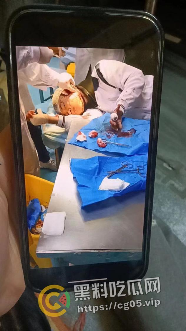 潮汕彩塘宏安中学学生砍人 女学生当场把同学耳朵砍掉 吓得学校学生第二天不敢来上学-4