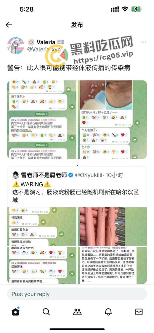 毁三观！逆天男娘在哈尔滨投毒被举报 性病晚期浑身流脓还准备卖塞进过自己直肠的烤肠创业 被热心群友举报进局子-4