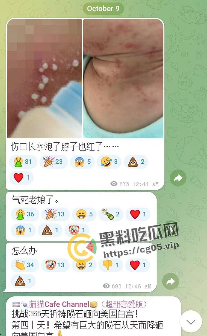 毁三观！逆天男娘在哈尔滨投毒被举报 性病晚期浑身流脓还准备卖塞进过自己直肠的烤肠创业 被热心群友举报进局子-10