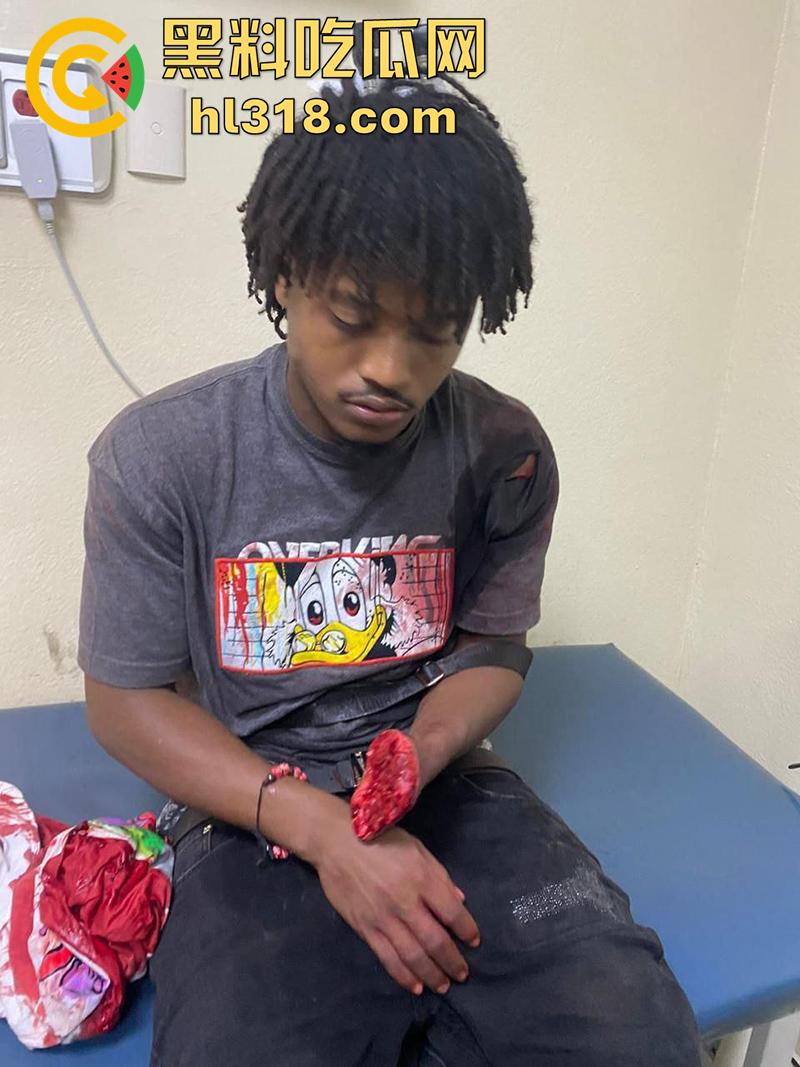 美国夜晚的恐怖，两拨黑哥发生冲突，老黑一刀将对方手掌切断，这刀是真快啊，这回估计要赔钱啦！-1