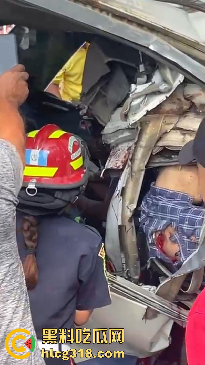 车祸没死脸却没了!印尼发生惨烈车祸,超速行驶失控撞上货车,乘客全部死亡司机面目全非!-4