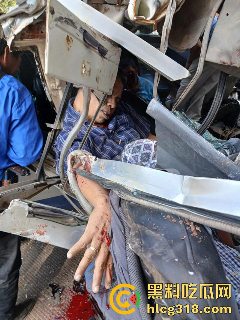 车祸没死脸却没了!印尼发生惨烈车祸,超速行驶失控撞上货车,乘客全部死亡司机面目全非!-6