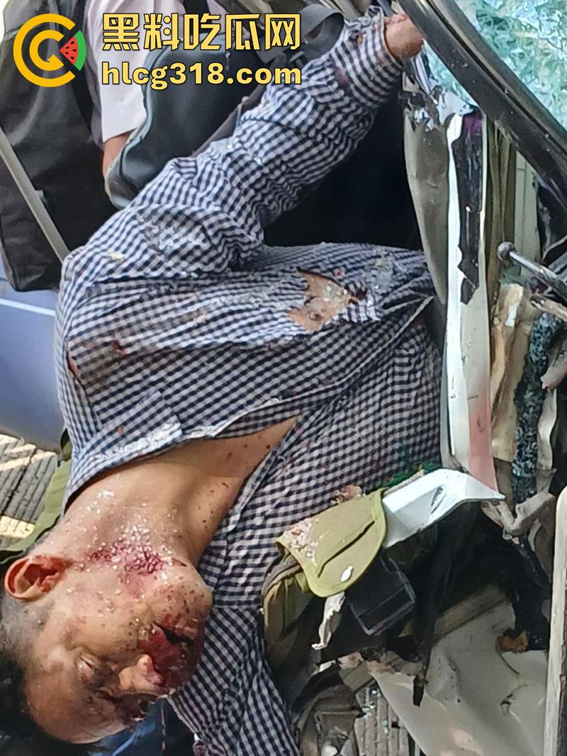 车祸没死脸却没了!印尼发生惨烈车祸,超速行驶失控撞上货车,乘客全部死亡司机面目全非!-7