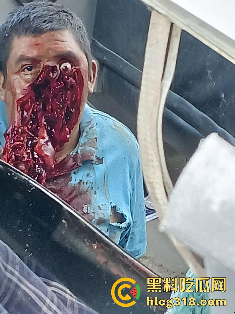 车祸没死脸却没了！印尼发生惨烈车祸，超速行驶失控撞上货车，乘客全部死亡司机面目全非！-8