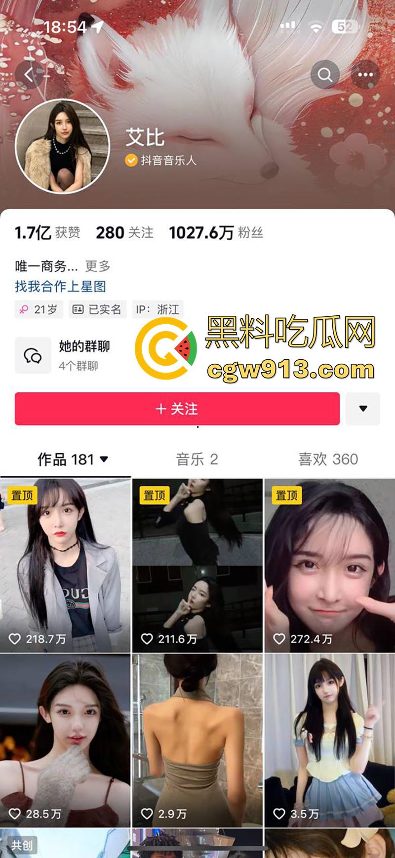 千万粉丝网红【艾比】，全网知名变性人，被爆出变性手术的前后对比，这小穴做的好逼真啊！-1