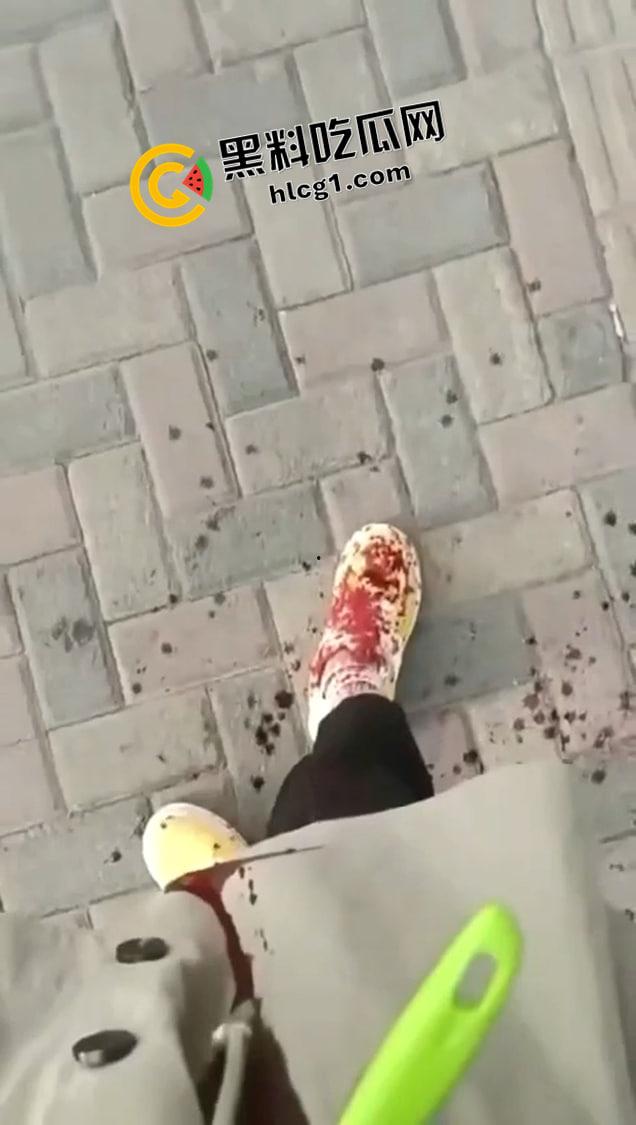血腥！女子医院前自杀 拍视频记录最后一刻 鲜血直流无人救援 这是多绝望才出此下策-1