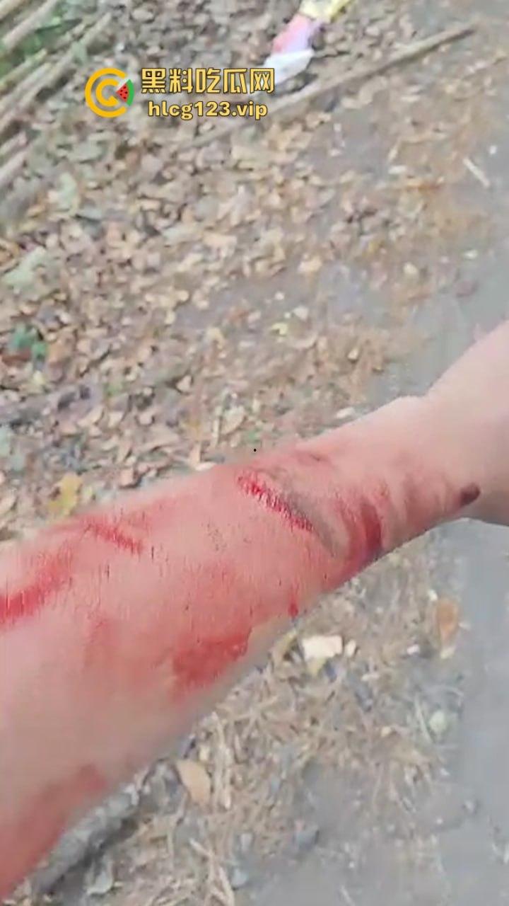 大型皮开肉绽现场！印尼一地发生冲突 有内战的国家真的不要去！-6