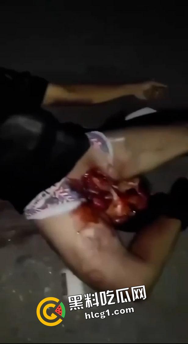 留学生圈又炸了!61当天加利福尼亚留学生男女车祸被腰斩 父母不愿收尸 现场血腥视频流出 这也太惨了-7