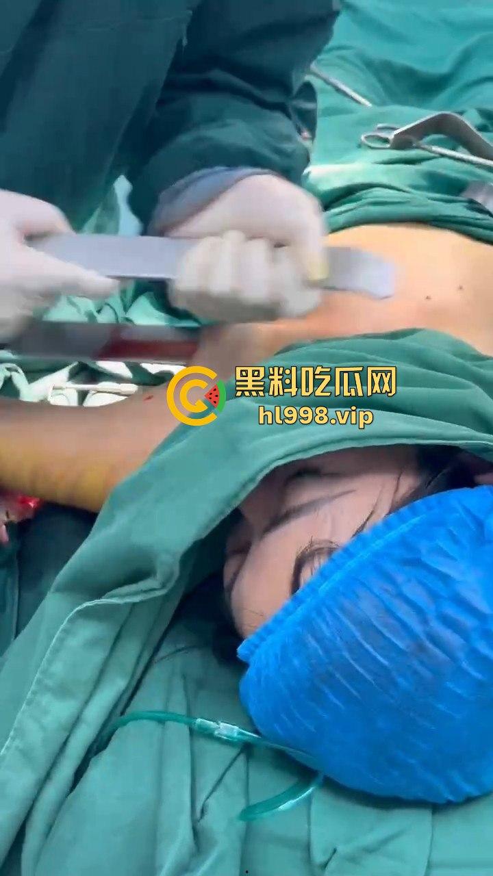 揭秘黄晓明女友『叶柯』同款隆胸术手术过程,看的让人心惊!胸被医生猛戳猛捣,视觉冲击强到不敢看!-14