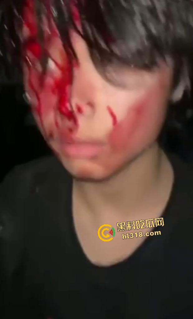 江西万载霸凌者反被群殴血溅当场!黄毛黑毛被打出心理阴影,棍子爆头血流不止,全靠路人打120急救!-8
